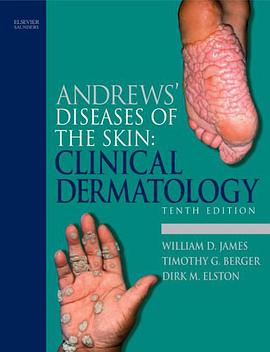 Andrews' Diseases of the Skin pdf epub mobi 电子书 下载