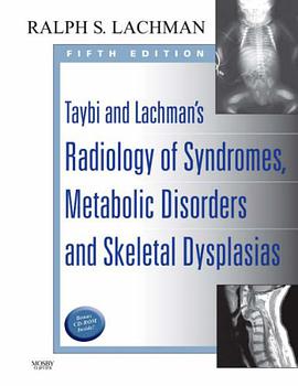 Taybi and Lachman's Radiology of Syndromes, Metabolic Disorders and Skeletal Dysplasias pdf epub mobi 电子书 下载