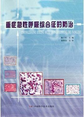 重症急性呼吸综合征的防治 pdf epub mobi 电子书 下载