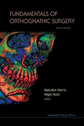 Fundamentals Of Orthognathic Surgery