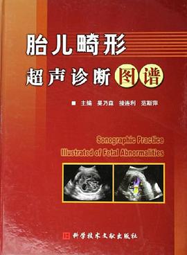 胎儿畸形超声诊断图谱 pdf epub mobi 电子书 下载