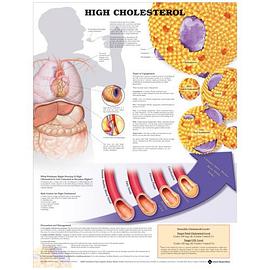 High Cholesterol Anatomical Chart pdf epub mobi 电子书 下载