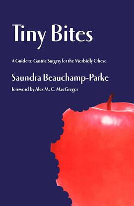 Tiny Bites pdf epub mobi 电子书 下载