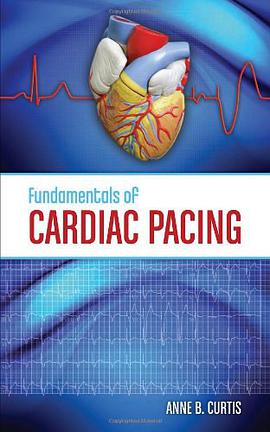 Fundamentals of Cardiac Pacing pdf epub mobi 电子书 下载