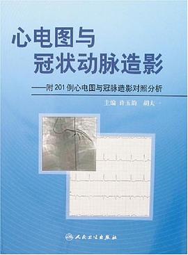 心电图与冠状动脉造影-附201例心电图与冠脉造影对照分析 pdf epub mobi 电子书 下载