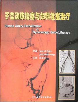 子宫动脉栓塞与妇科栓塞治疗 pdf epub mobi 电子书 下载