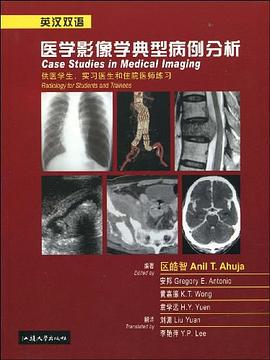 医学影像学典型病例分析 pdf epub mobi 电子书 下载