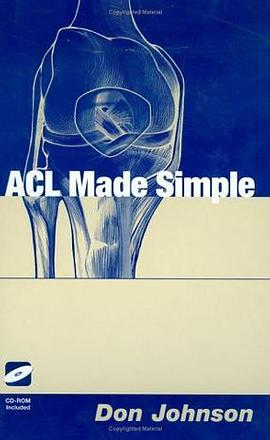 ACL Made Simple pdf epub mobi 电子书 下载