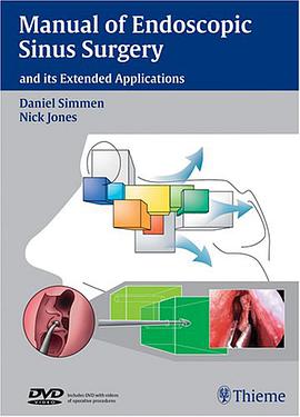 Manual of Endoscopic Sinus Surgery