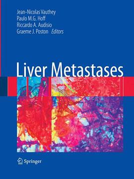 Liver Metastases pdf epub mobi 下载