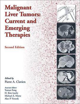 Malignant Liver Tumors pdf epub mobi 电子书 下载