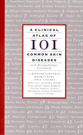 A Clinical Atlas of 101 Common Skin Diseases pdf epub mobi 电子书 下载