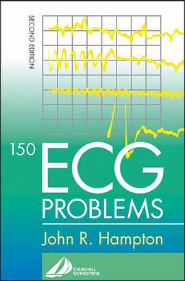 150 ECG Problems pdf epub mobi 下载