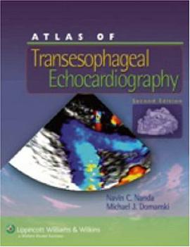 Atlas of Transesophageal Echocardiography pdf epub mobi 电子书 下载