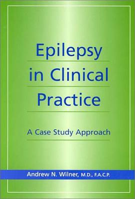 Epilepsy in Clinical Practice pdf epub mobi 电子书 下载