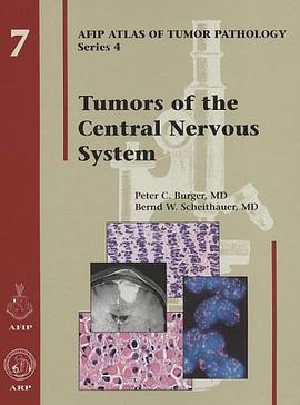 Tumors of the Central Nervous System pdf epub mobi 电子书 下载