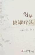 圖解拔罐療法 pdf epub mobi 電子書 下載