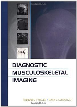 Diagnostic Musculoskeletal Radiology pdf epub mobi 下载