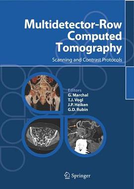 Multidetector-Row Computed Tomography pdf epub mobi 电子书 下载