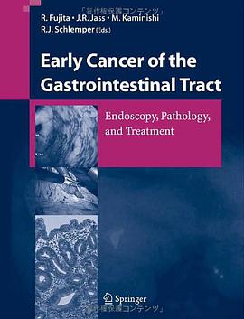 Early Cancer of the Gastrointestinal Tract pdf epub mobi 下载