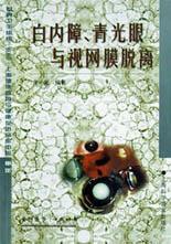 白内障、青光眼与视网膜脱离 pdf epub mobi 电子书 下载
