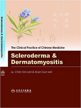 Scleroderma & Dermatomyositis (The Clinical Practice of Chinese Medicine) pdf epub mobi 电子书 下载