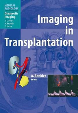 Imaging in Transplantation pdf epub mobi 电子书 下载