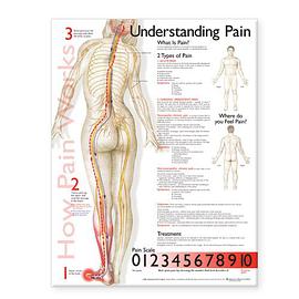 Understanding Pain Anatomical Chart pdf epub mobi 电子书 下载