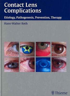 Contact Lens Complications pdf epub mobi 电子书 下载