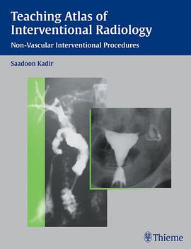 Teaching Atlas of Interventional Radiology pdf epub mobi 电子书 下载