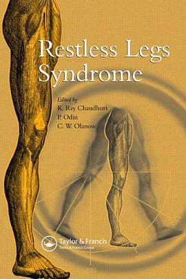 Restless Legs Syndrome pdf epub mobi 电子书 下载