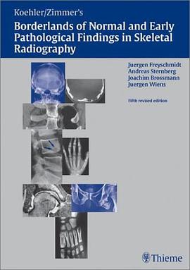 骨放射正常表现与早期病理表现的界限Borderlans of Normal and Early Pathological Findings in Skeletal Radiography pdf epub mobi 电子书 下载