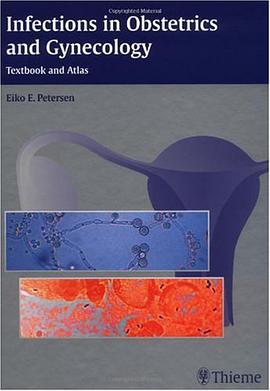 Infections in Obstetrics and Gynecology pdf epub mobi 电子书 下载