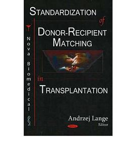 Standardization of Donor-Recipient Matching in Transplantation pdf epub mobi 电子书 下载