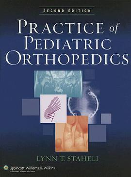 Practice of Pediatric Orthopedics pdf epub mobi 电子书 下载