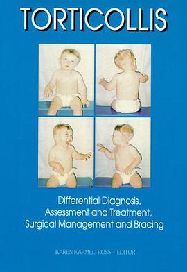 Torticollis pdf epub mobi 電子書 下載