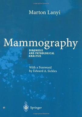 Mammography