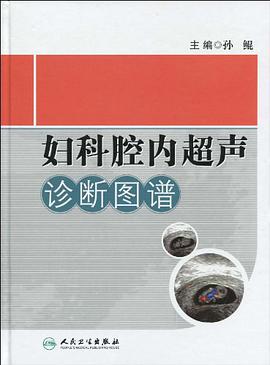 婦科腔內超聲診斷圖譜 pdf epub mobi 電子書 下載