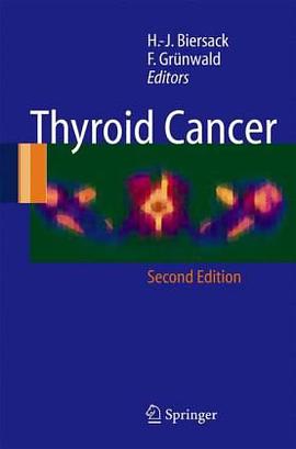 Thyroid Cancer pdf epub mobi 电子书 下载
