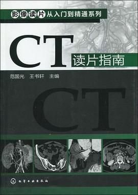 CT读片指南 pdf epub mobi 电子书 下载