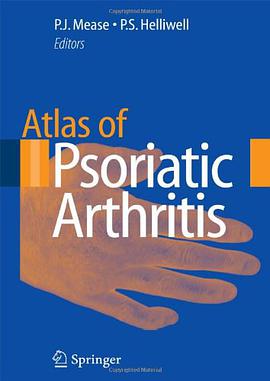 Atlas of Psoriatic Arthritis pdf epub mobi 电子书 下载