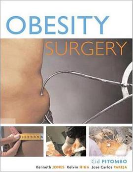 Obesity Surgery