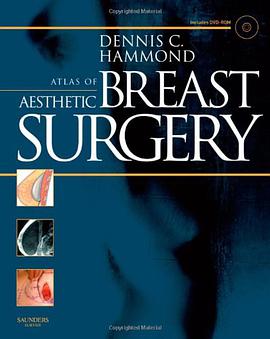 Atlas of Aesthetic Breast Surgery pdf epub mobi 电子书 下载