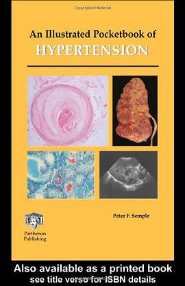 An Illustrated Pocketbook of Hypertension pdf epub mobi 电子书 下载