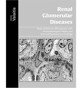 Renal Glomerular Diseases pdf epub mobi 電子書 下載