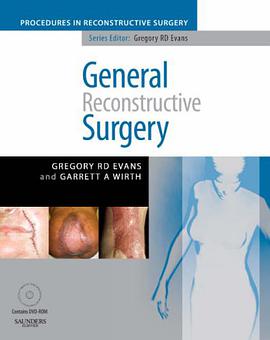 General Reconstructive Surgery with DVD pdf epub mobi 电子书 下载