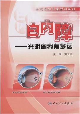 白内障 pdf epub mobi 电子书 下载