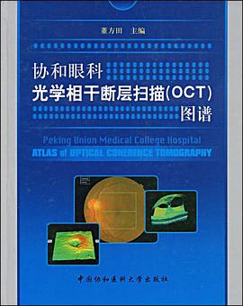 协和眼科光学相干断层扫描 pdf epub mobi 电子书 下载
