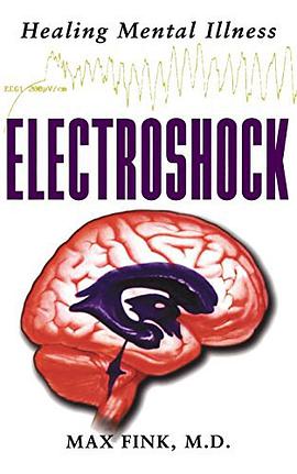 Electroshock pdf epub mobi 電子書 下載