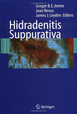 Hidradenitis Suppurativa